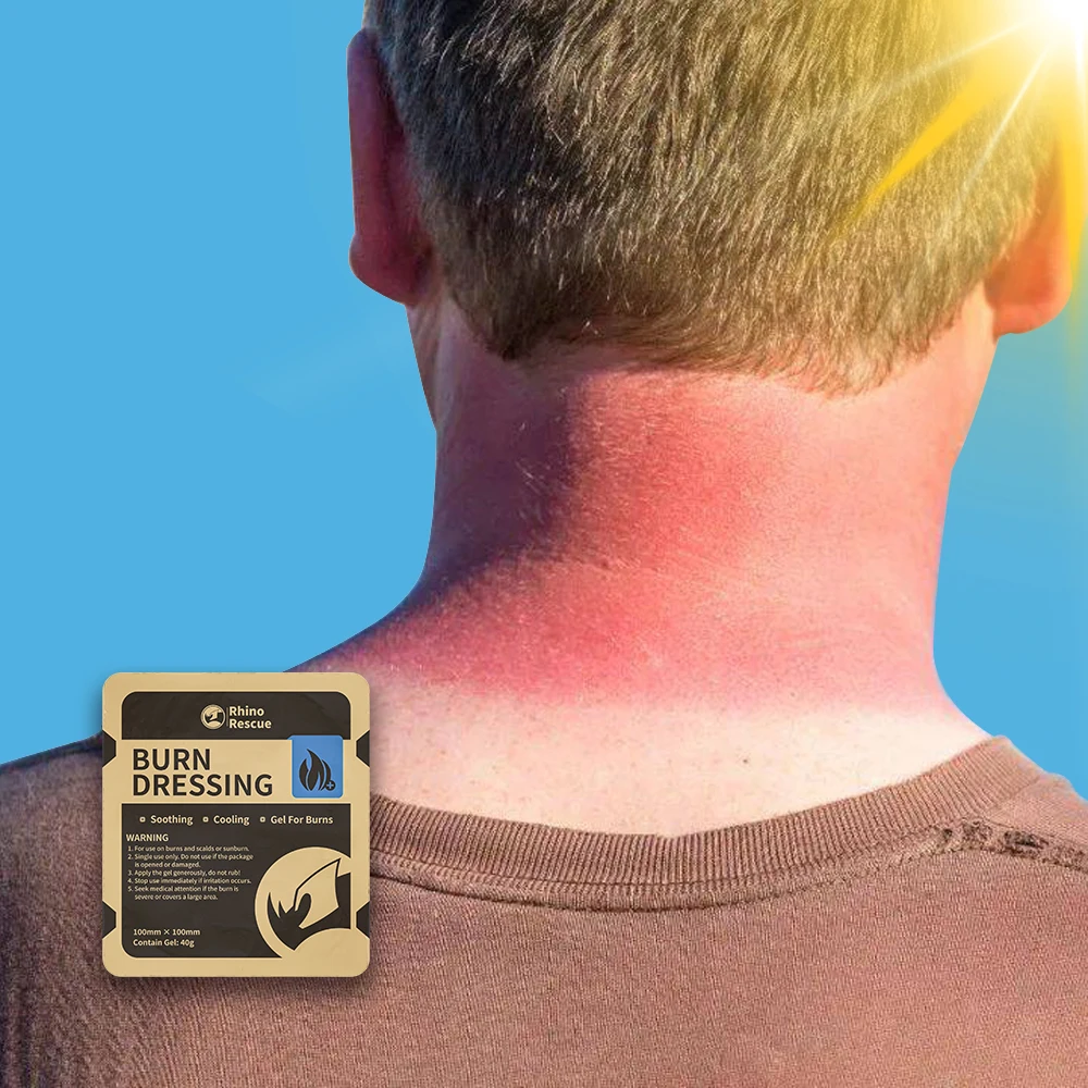 RHINO 레스큐 화상 케어 키트: 화상 드레싱, 화상 젤 패킷, 냉각 크림, 화상 응급 처치 키트
