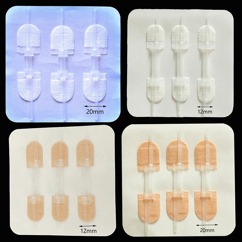 휴대용 지퍼 타이 상처 폐쇄 패치, 지혈 패치, 상처 빠른 봉합 지퍼 밴드, 야외 안전 생존 지원, 3 개/세트