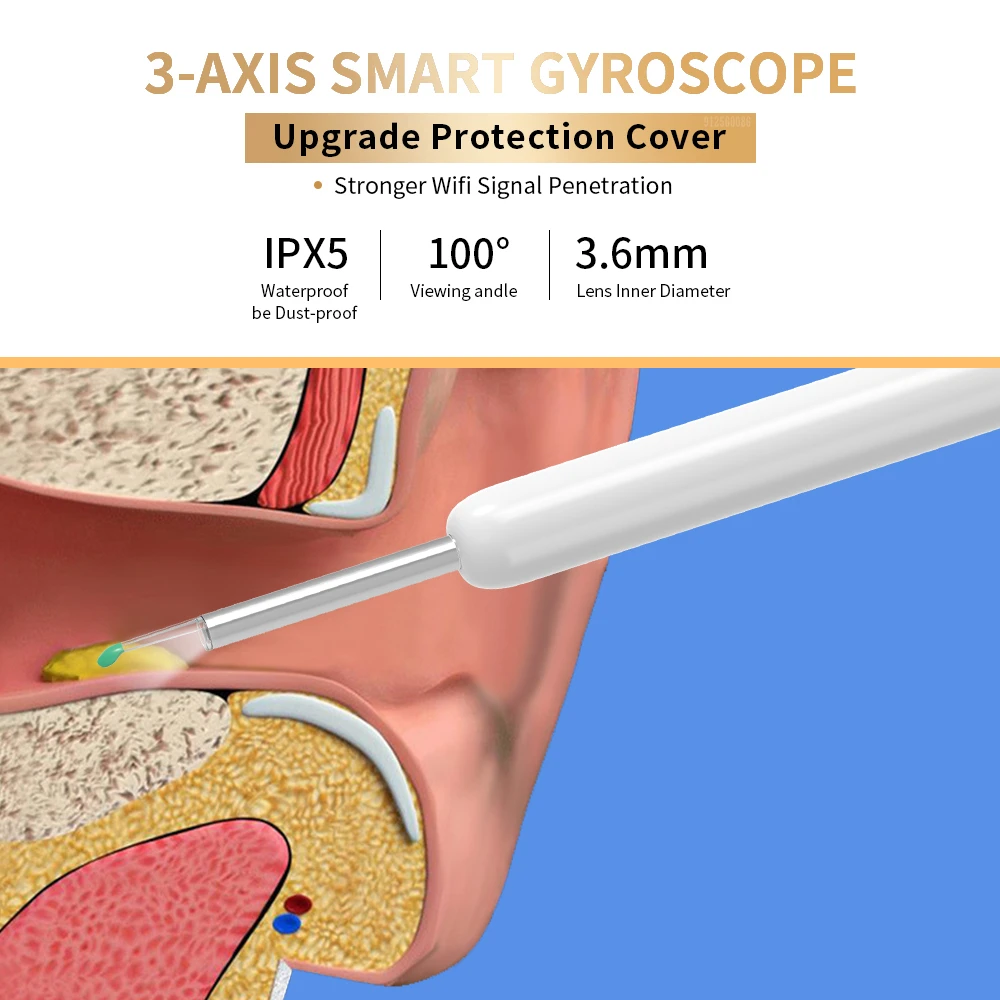 NE3 귀 청소기 카메라와 함께 고정밀 귀 왁스 제거 도구 LED 빛 무선 Otoscope 스마트 귀 청소 키트 최고의 선물