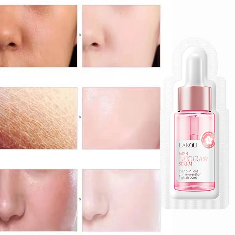 사쿠라 얼굴 관리 세럼, 부드러운 주름, 얼굴 리프팅, 모이스처라이저, 미백, 한국 스킨 케어 제품, 1.5ml * 3